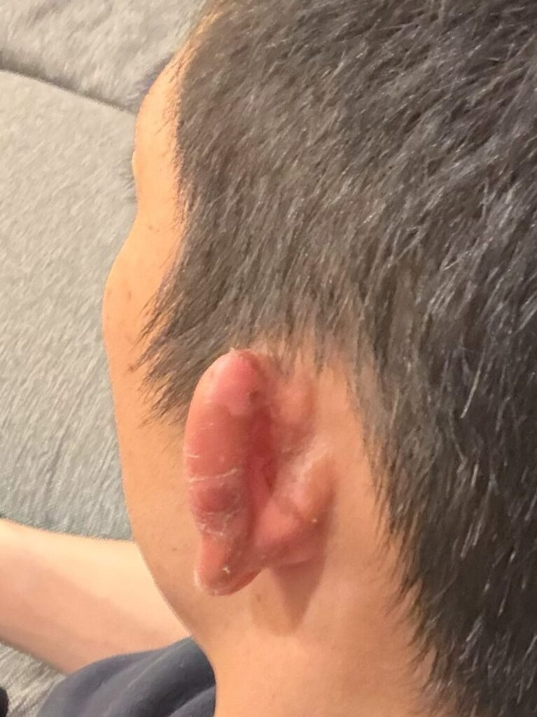 キモ耳